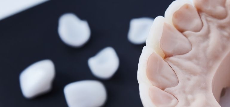 common-dental-problems-how-you-can-tackle-them