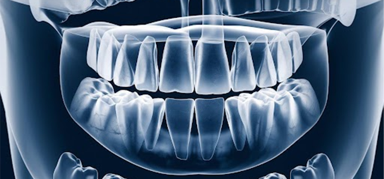 common-dental-problems-how-you-can-tackle-them