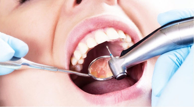 Best Root Canal Treatment in Seawoods, Navi Mumbai